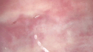 身体測定 健康診断 GIF エロ画像 【54】