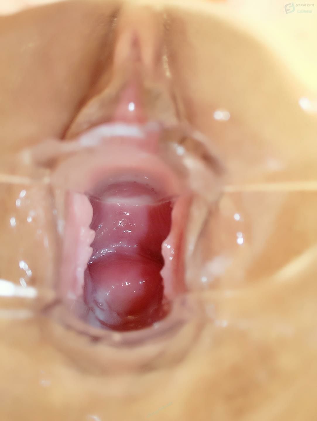 鴨嘴擴陰器讓你看明白[25P]