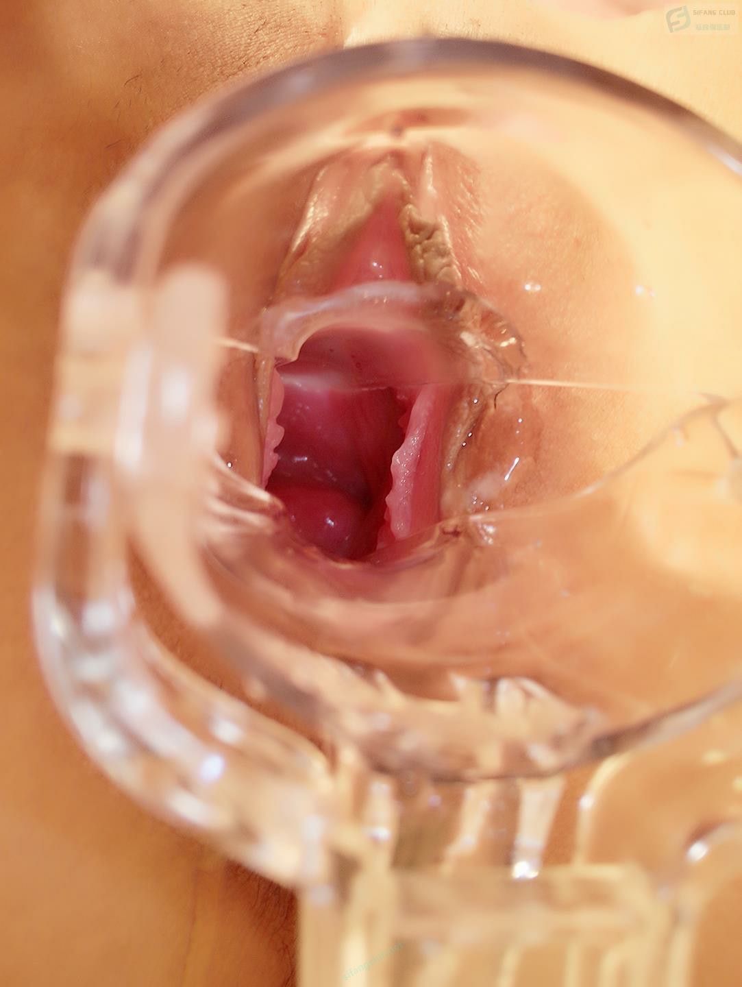 鴨嘴擴陰器讓你看明白[25P]