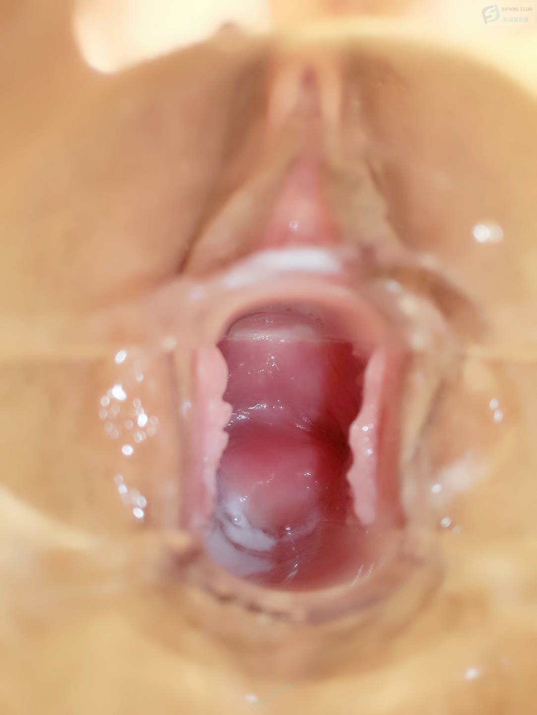 鴨嘴擴陰器讓你看明白[25P]