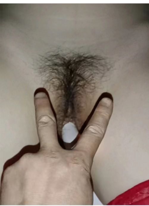 [原创]遊客投稿，36歲的大屁股老婆外穿紅色絲襪，狂露騷穴，請品嚐。[20P]