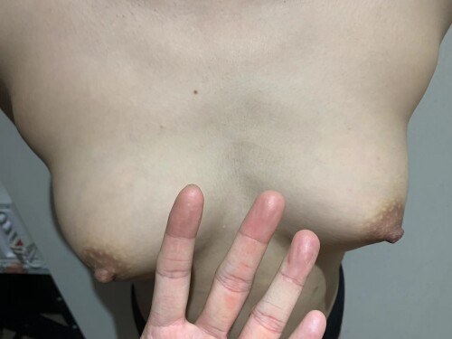 [原创]期待已久的戶外露出來啦~榴友多多評論互動[16P]