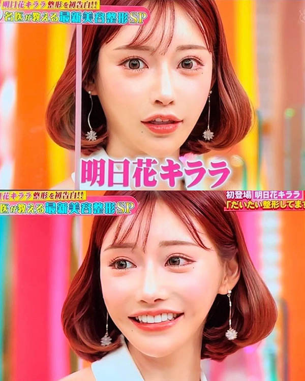 「明日花綺羅」首度承認全臉整形！但超完美「G罩杯豪乳」是純天然性感曲線！